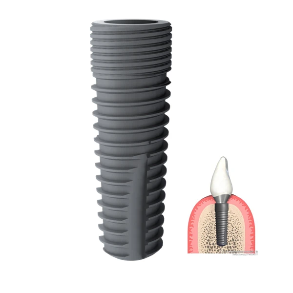 
Implant dental Titanium dental implant manufacturer 3.4 3.8 4.3 5.0mm Diameter dental Implant distributor wanted 