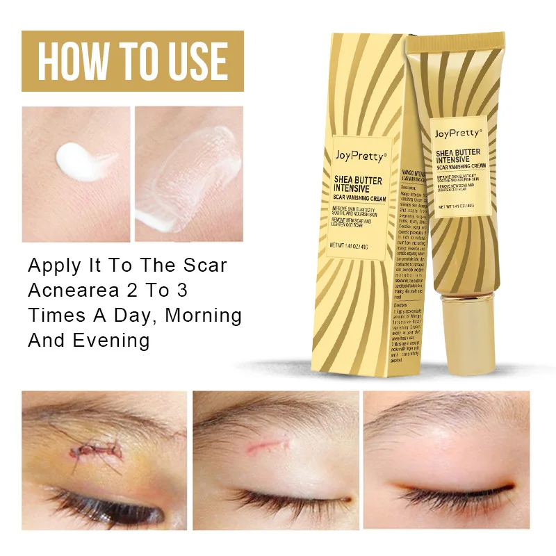 Herbal Acne Spots Treatment Burn Surgical Scars Smooth Whitening Face Body Skin Care Acne Scar Removal Cream