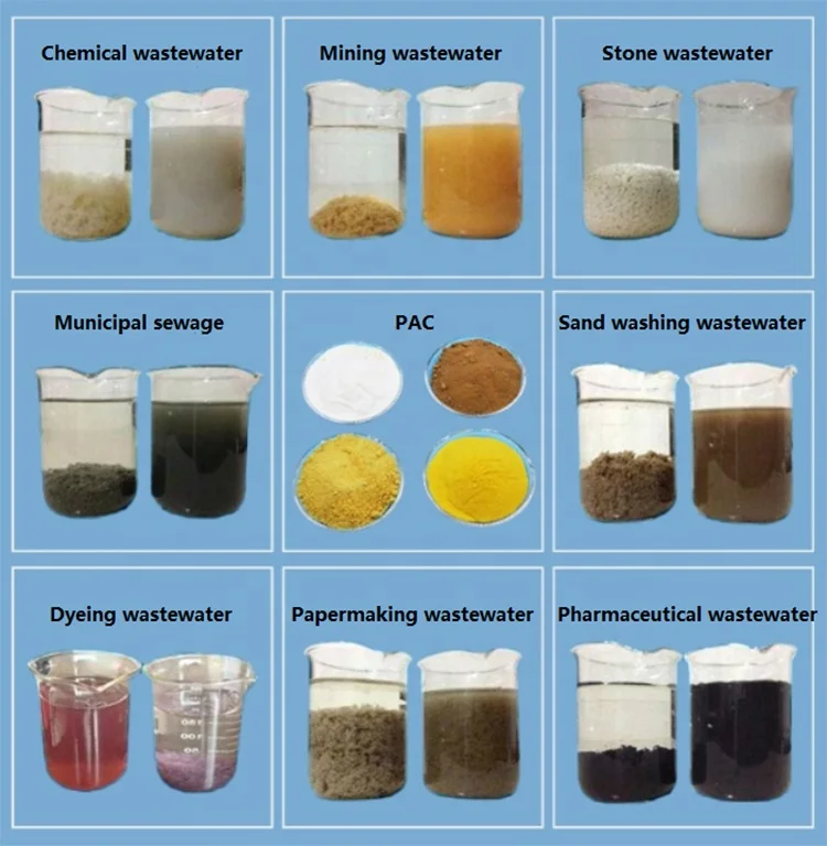 Gongyi XINQI White Granules Anionic Polyacrylamide flocculant anionic flocculant cationic flocculant