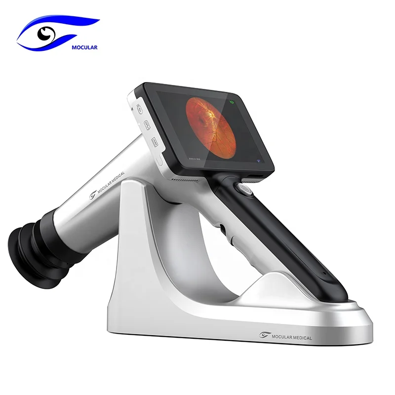 Одобренное CE офтальмологическое оборудование, портативная камера