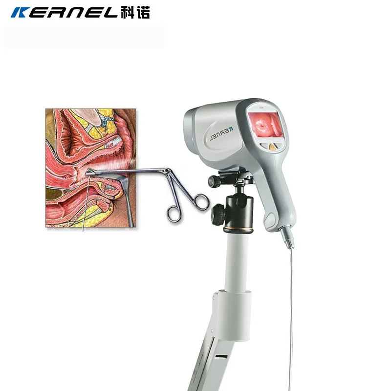 Цифровой видеоролик Colposcopy для экзамена гинекологии