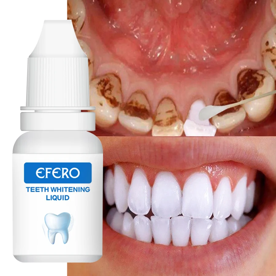 EFERO Teeth Whitening liquid professional easy white teeth whitening essence