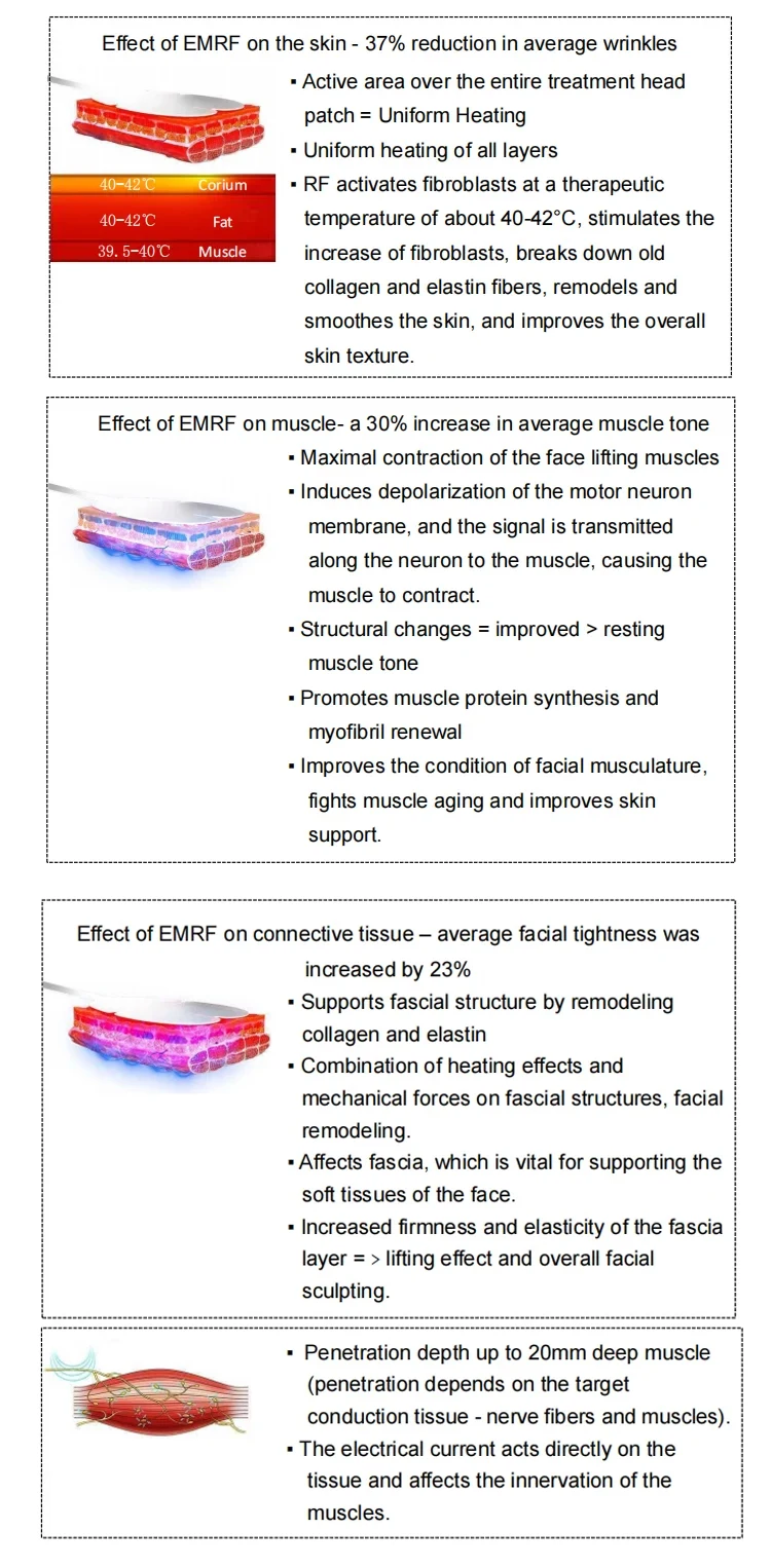 Best Selling Non Invasive Emrf Emrf Machine 3-Hadle Portable Emrf Face Rf Face Lifting Machine For Reduces Wrinkles
