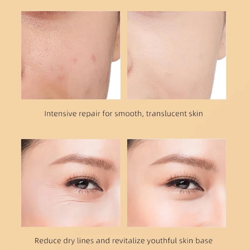 Custom 100ml Skin Ordinary Moisturizer Facial Cream Oem Private Label Korean Snail Repairing Face Cream