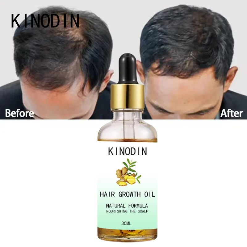 100% Органическая формула быстрое укрепление розмариновое масло анти-потеря имбирь травяная биотиновая Сыворотка для роста волос