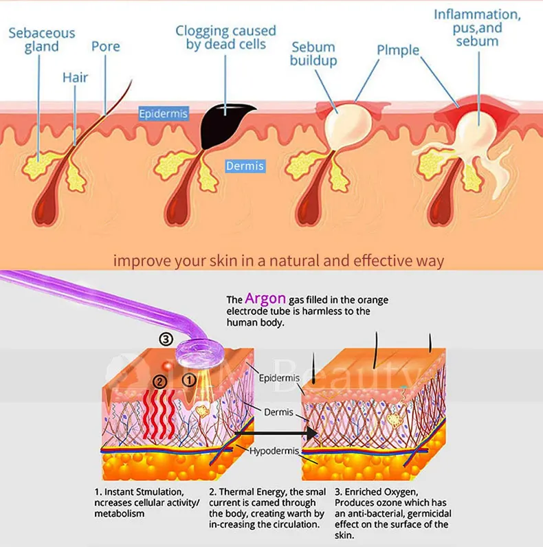 2022 MARCH EXPO Promotional Products Portable High Frequency Facial Machine