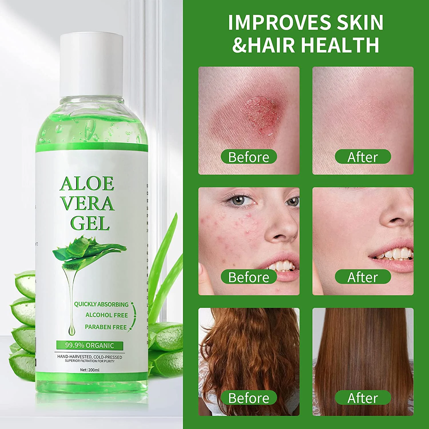 Private Label Moisturizing Face Cream with Remove Acne Sun Burn Powerful Repair Aloe Vera Soothing Gel