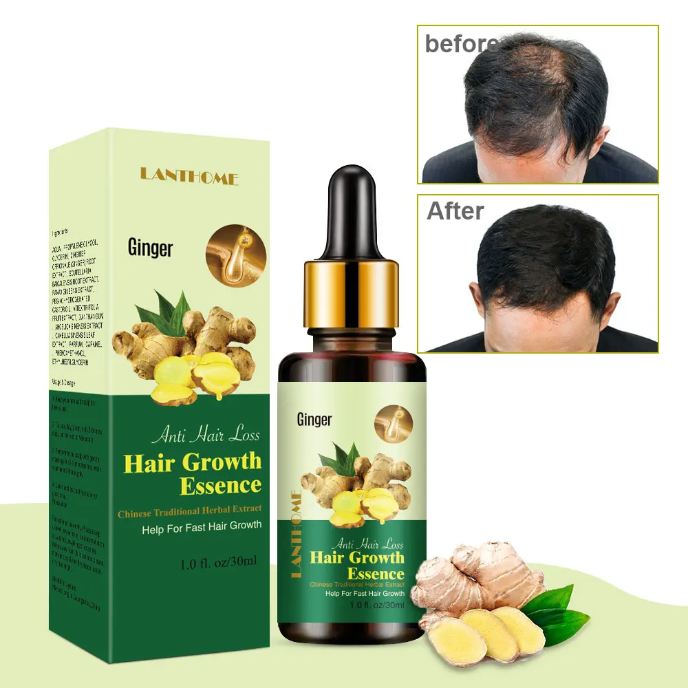 Natural Hair Regrowth Oil Hair Massage Oil Hair Refreshing Oil Hot Sale Balance  Control Product