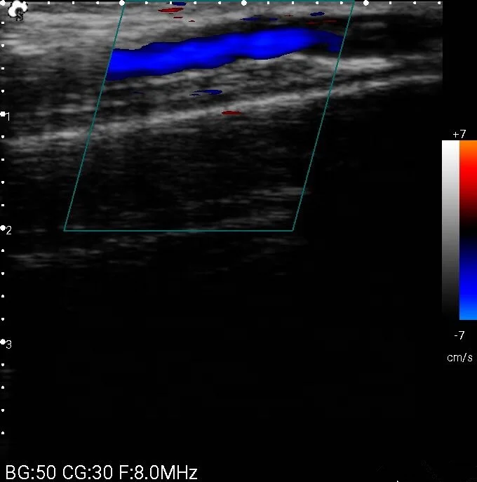 
1280*720 High Resolution Pocket Color Ultrasound Device Mini Handheld WIFI Ultrasound USB Probe 