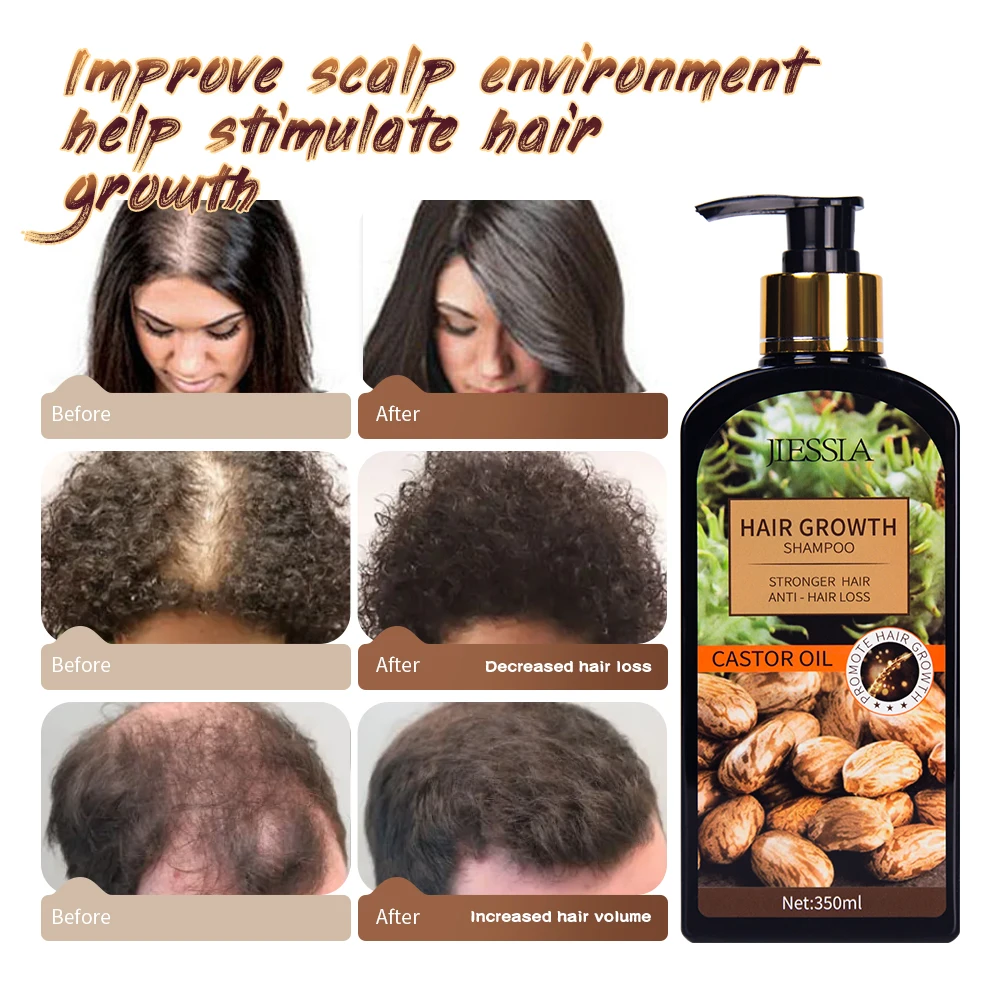 Bald Castor Oil Hair Growth Anti-hair Loss Shampoo