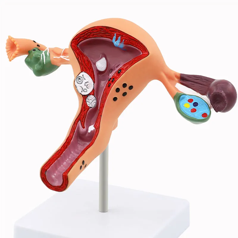 Female Plastic  Uterus Ovary Anatomical Model Vagina Model Normal/diseased Uterus Model