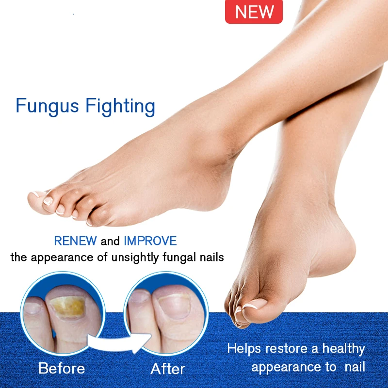 Private Label Antifungi Oil Fungal Infection Treatment Nail Repair