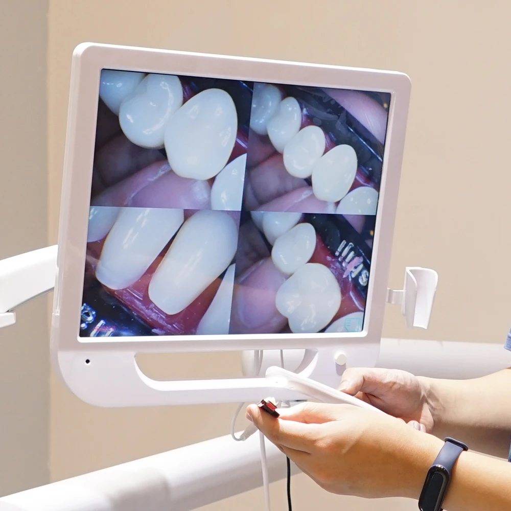 AliGan Dental equipment intra oral endoscope with 1280 x 1024 pixels 17-inch display 6 LED light beads 1/4 CMOS Image Sensor