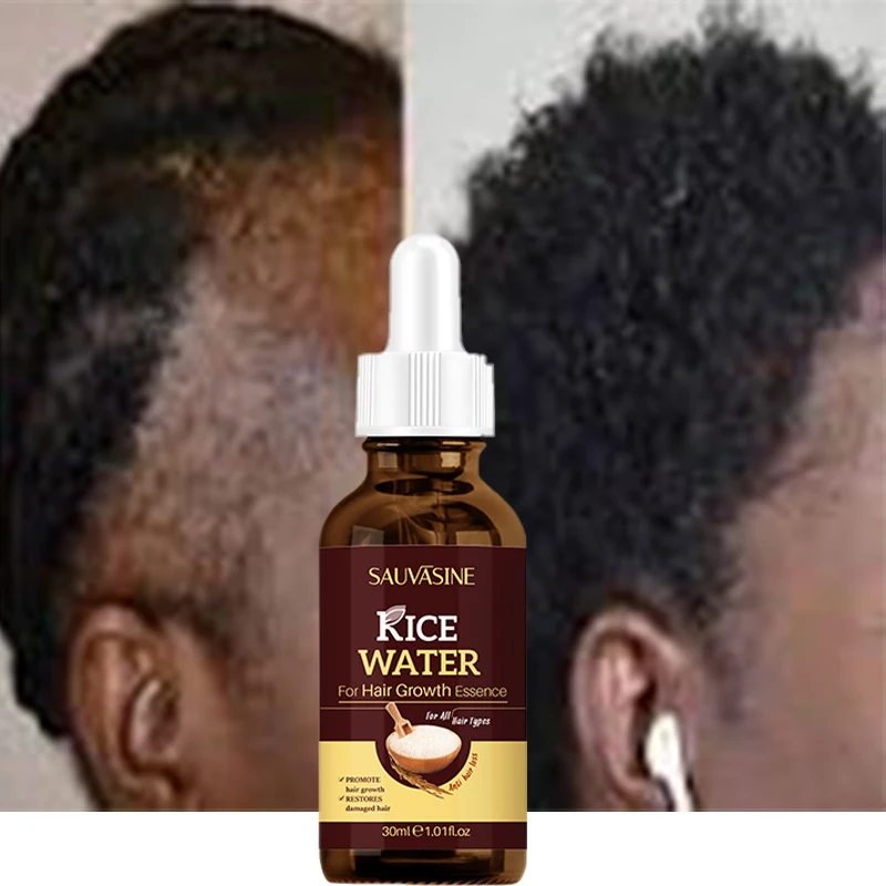 Private Label Hair Treatment Growth Serum Hair Loss Treatment Instant Rice Water Hair Growth Serum