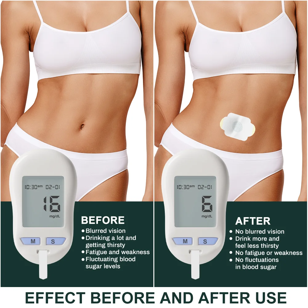 Sumifun Adult acupoint plaster application effective hypoglycemic ointment paste