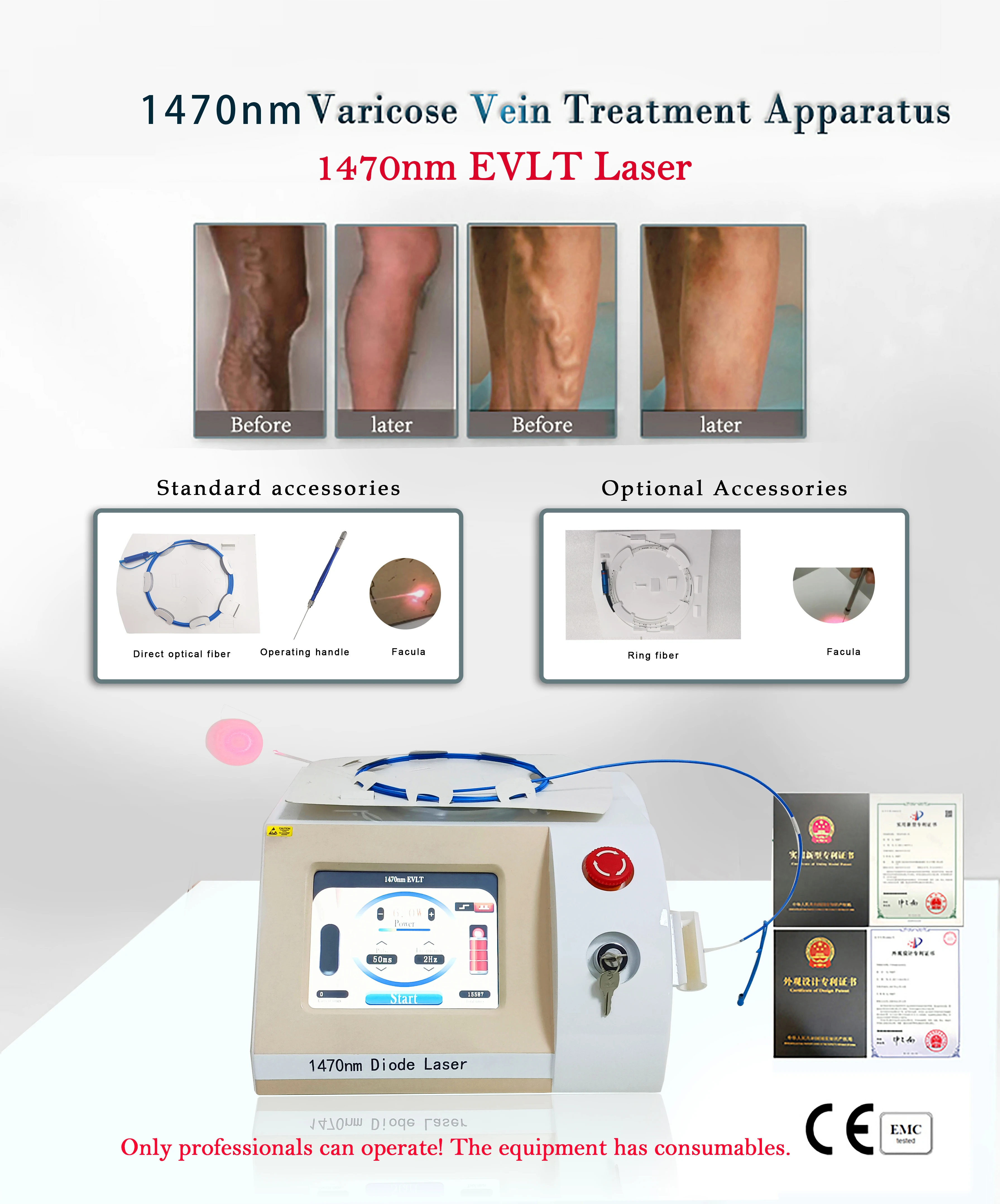 OEM/ODM evlt 1470nm diode laser Evlt medical laser machine varicose vein laser treatment 1470nm