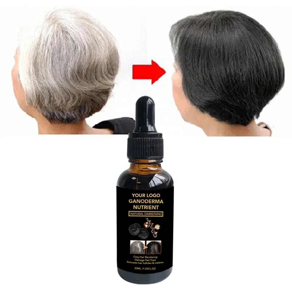 Hair Treatment Growth Oil Turn White Hair To Black Permanent Anti Grey Hair Treatment