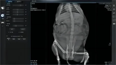 Заводская низкая цена несколько режимов медицинского оборудования система записи рентгеновского аппарата DR-машина