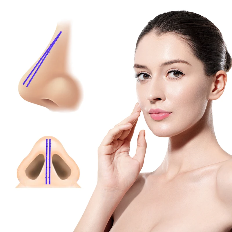 Beautlift pdo nose cog thread nasal lifting tensioning threads 3d