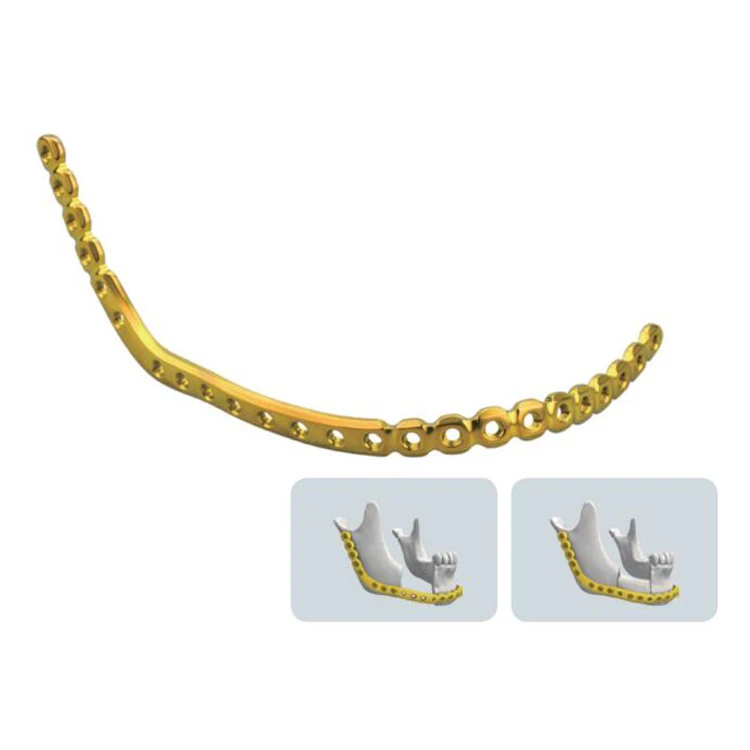 Orthopedic Titanium Maxillofacial Plate
