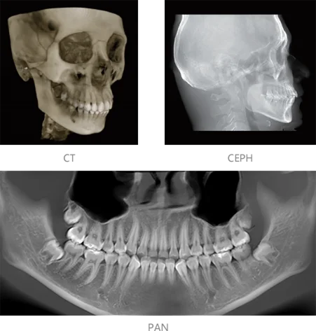 Hospital Dental Equipment Intelligent 3D CBCT Panoramic Imaging Machine Dental X-ray Machine