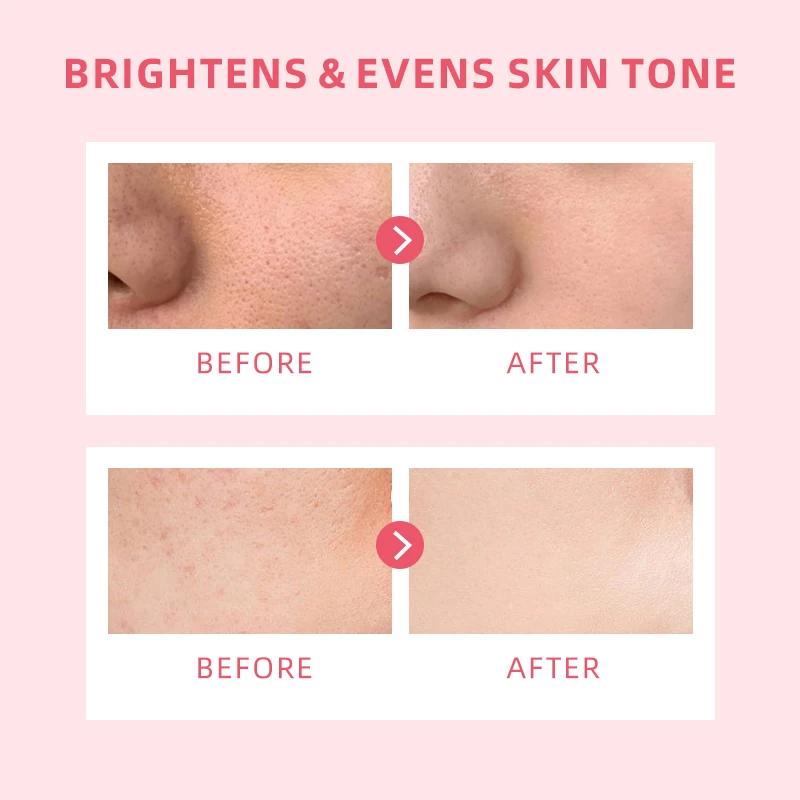 Wholesale 5x Ceramide MSH Niacinamide Brightening Moisture Gel Alpha Arbutin Tranexamic Acid Evens Skin Dark Spots Face Cream