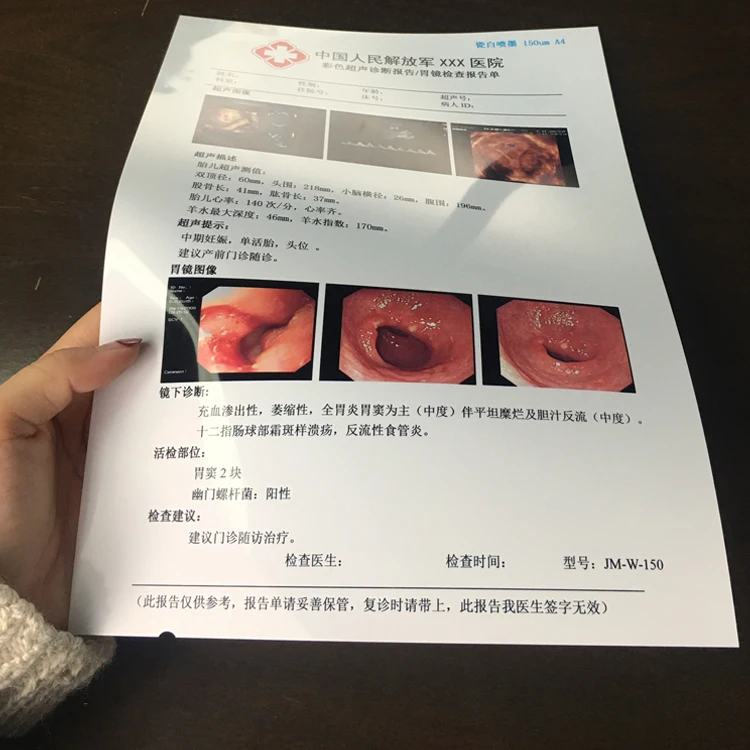 A4 White Ultrasound Inkjet Printable Dicom Medical Film