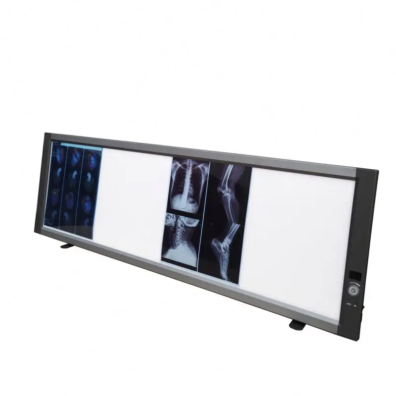 MSLZG4CAdjustable Medical LED X Ray Imaging Film Viewer Quadruple View Box