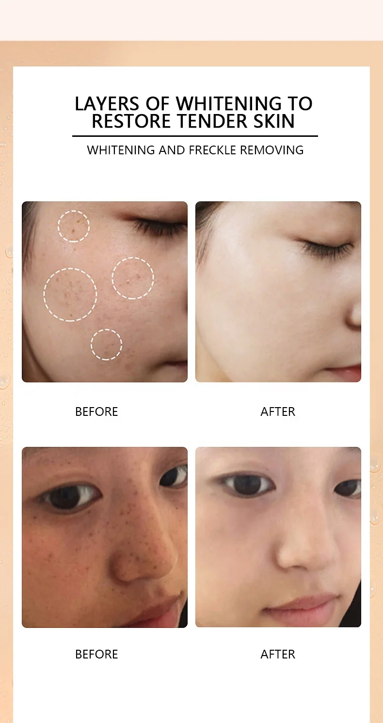 Oem Collagen Cream Skin Improving Whitening And Freckle Removing Cream