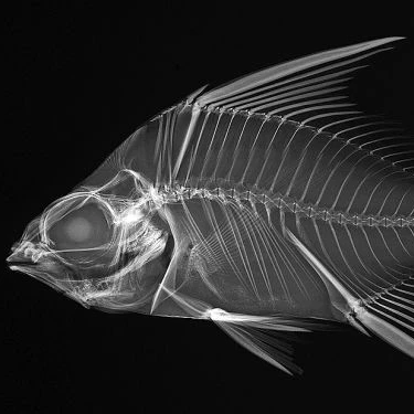 carestream dryview dvb laser imaging film x ray kodak laser x-ray kodak medical film