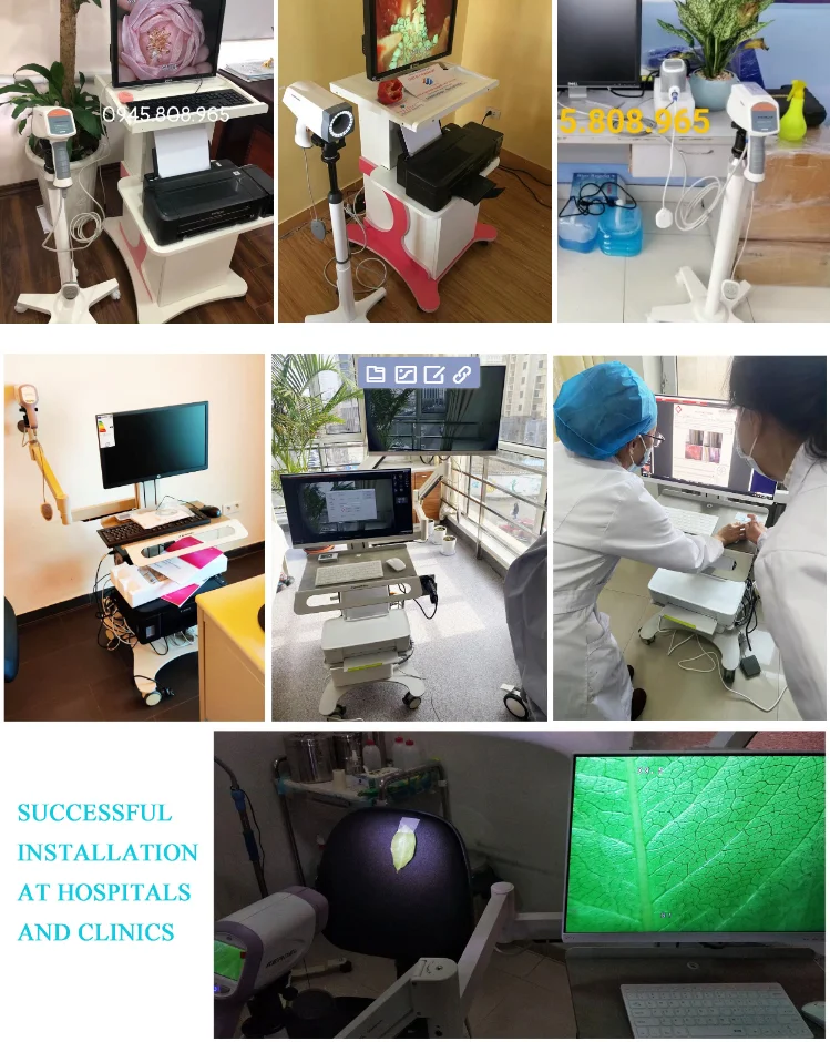 Digital video camera colposcopio kernel medical HD Optical digital Colposcope kn-2200a for gynecology cervical cancer prescreen