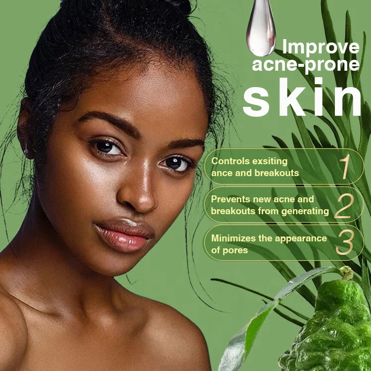 ailke wholesale best salycilic acid acne pimple face brightening anti-acne serum facial