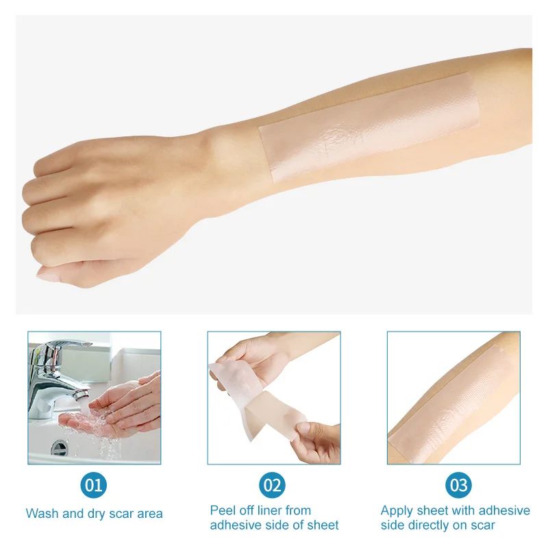 Medical-grade silicone dressing scar removal Patch Self-adhesive scar repair tape patch