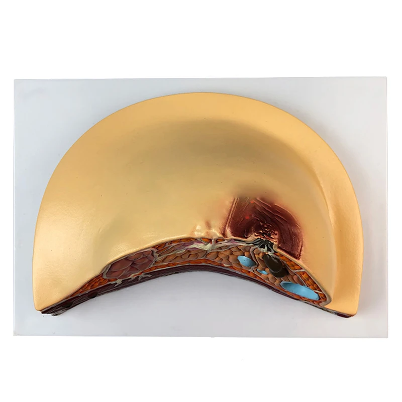 Medical Anatomy System Human Pathology Breast Model For Female Breast Healthy