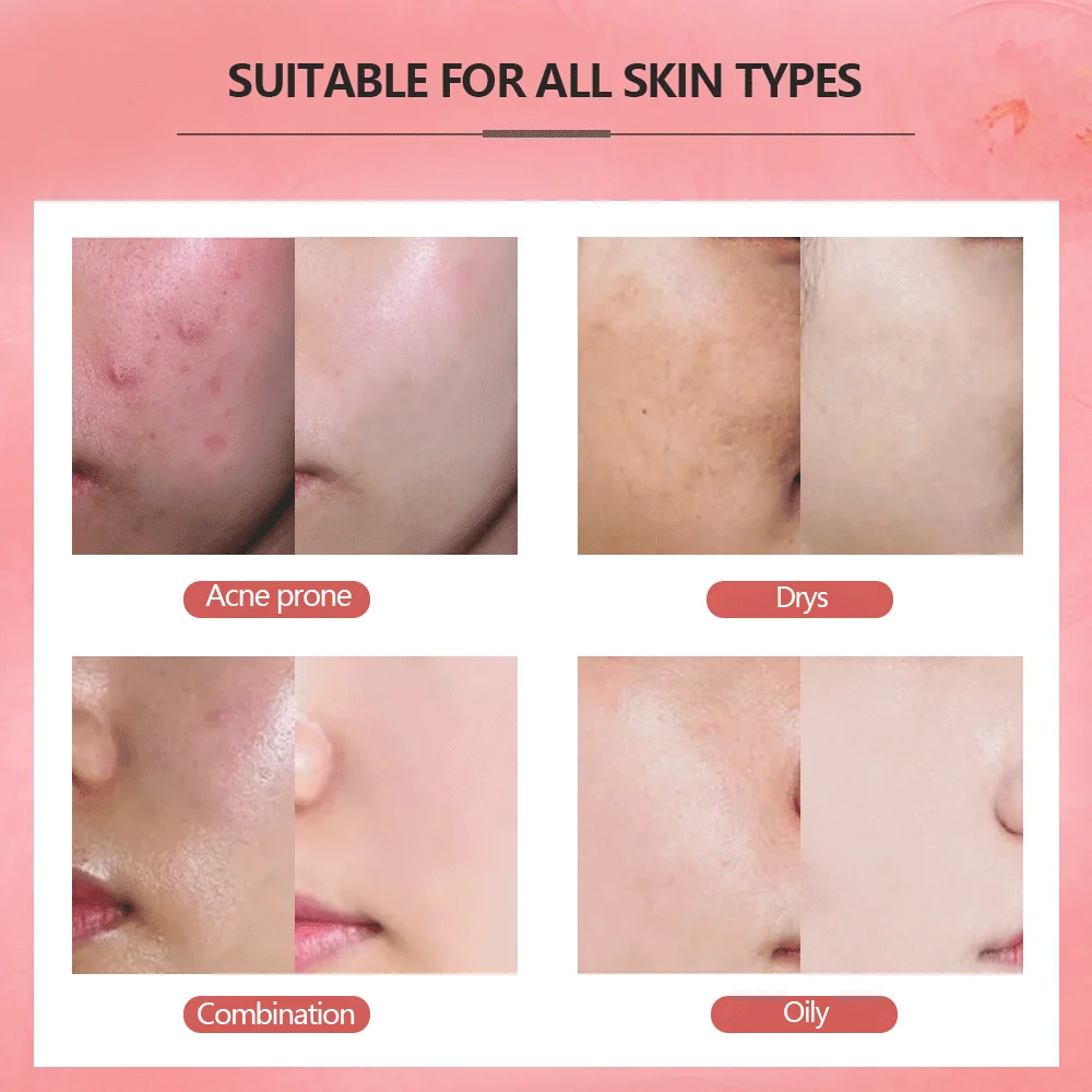 Skin Care Pink Mud Clay Face Mask for Blackhead Acne Removal