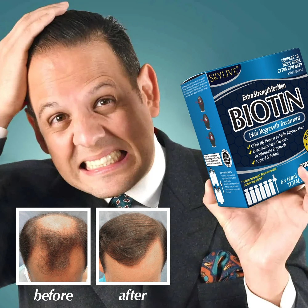 Biotin Hair Growth Serum For Anti Loss Essential Oil Products Fast Treatment Prevent Thinning Dry Frizzy Repair Private Label