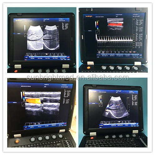 SUN-906B Portable Color Doppler scan High-end Rectal probe Veterinary ultrasound for pig sheep cattle goat