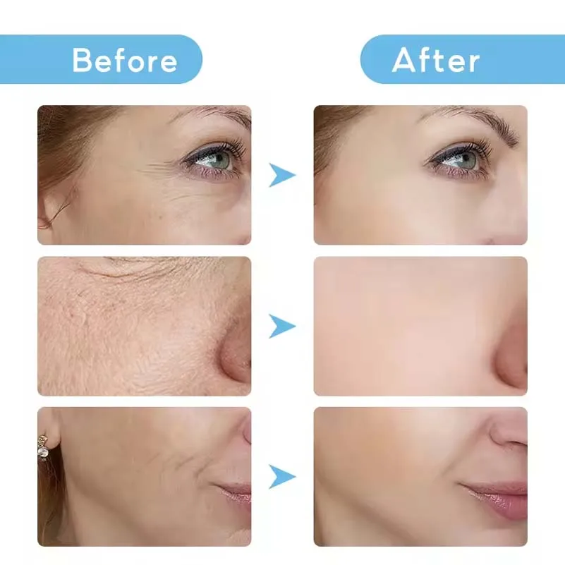 Pure Hyaluronic Acid Serum for Anti-Aging Deep Nourish Delicate Care Product Hyaluronic Acid Serum For Face With Vitamin