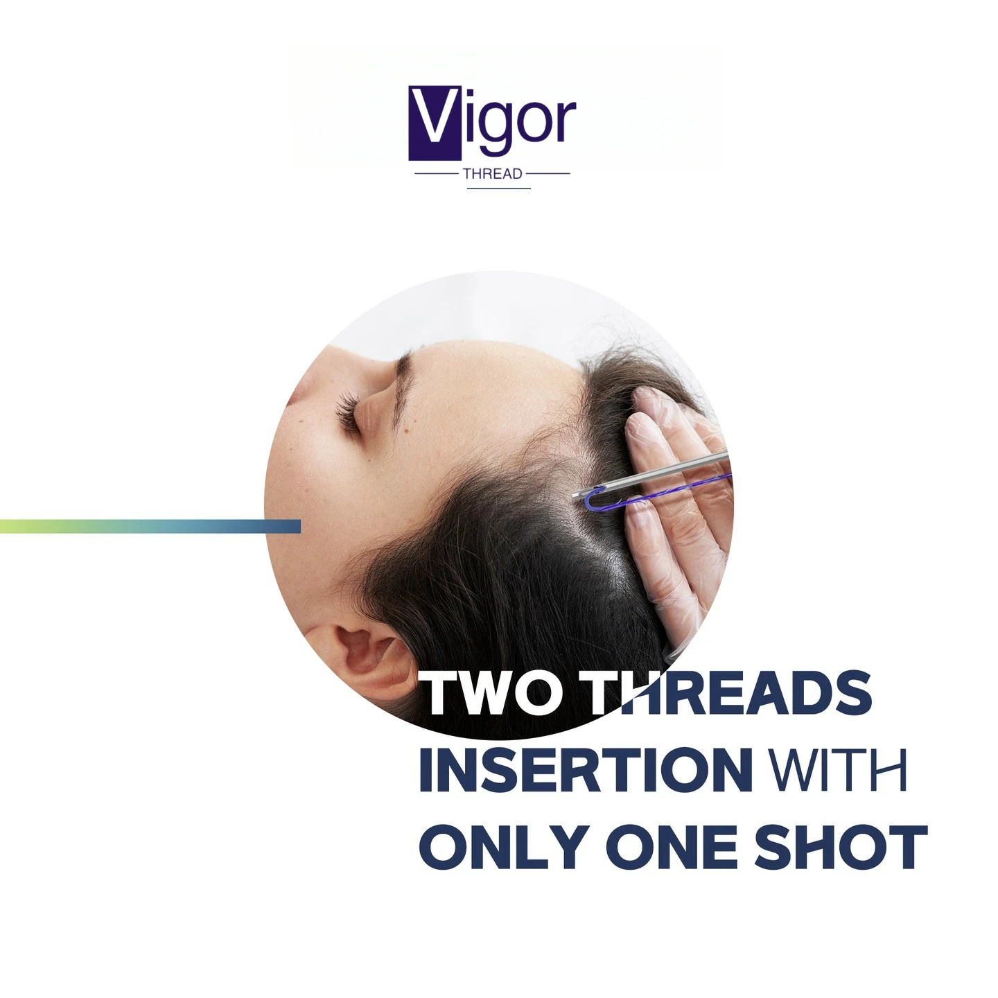 VIGOR wholesale hilos pdo lifting threads korean hilos fishbone mono cog thread lift 8d 18g 100mm korea pdo 3d thread tensioners