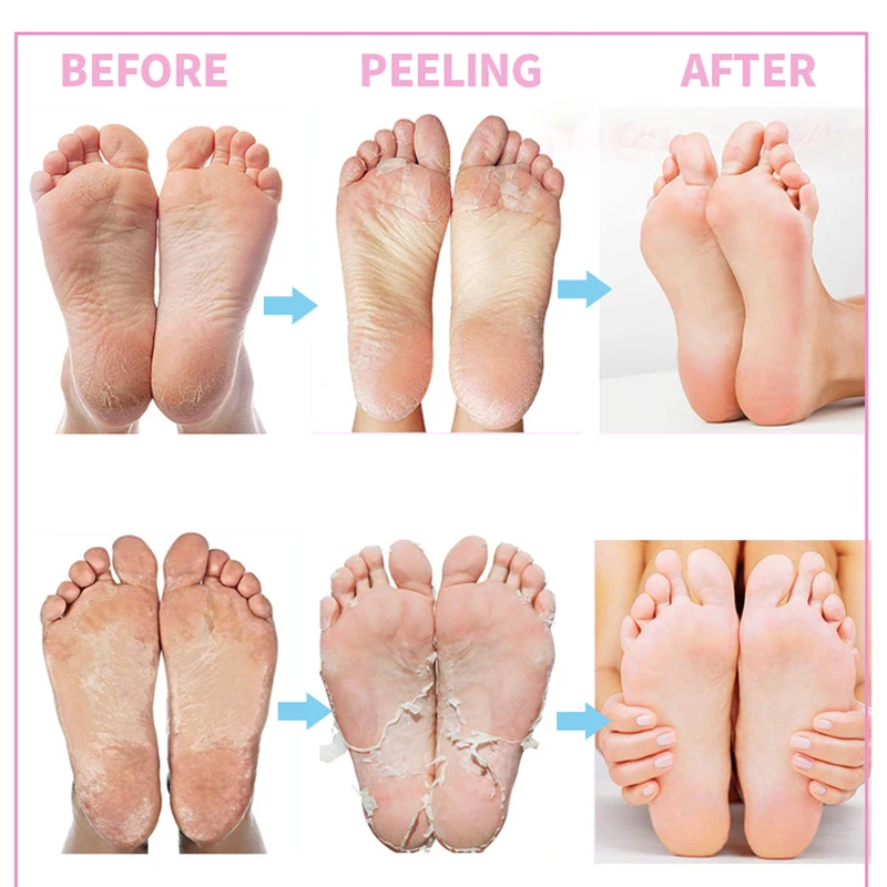 Private Label Black Skin Honey Peeling Lightening Whitening Exfoliating Hand And Body Lotion Dark Knuckles Removal Hand Mask