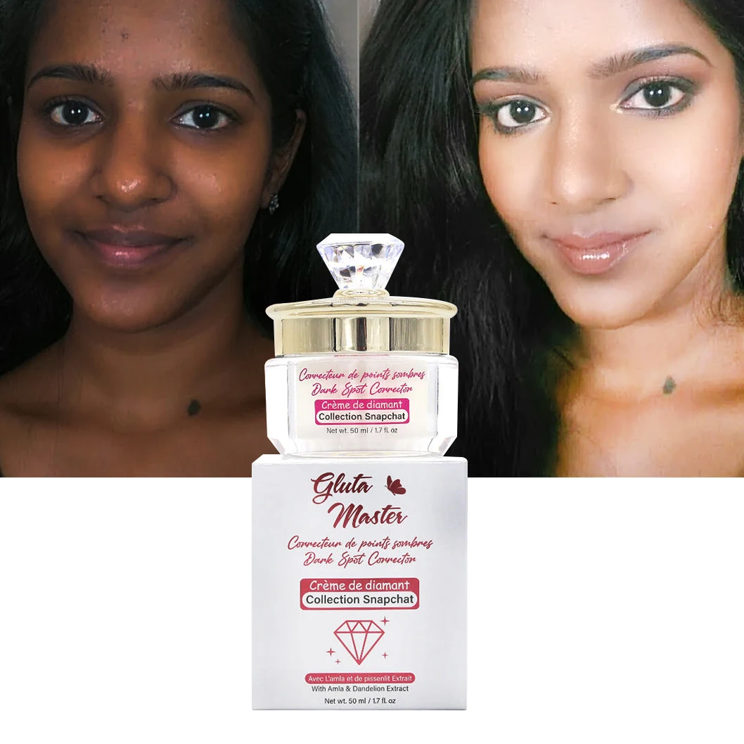 Отбеливающий крем для лица с темными пятнами