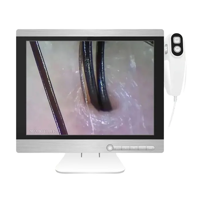 HD Detection Probe-10 Million Pixels SA-S15 hair analyzer scalp