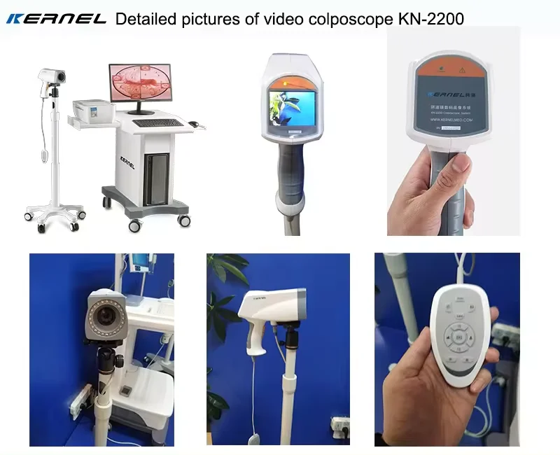 Kernel KN-2200 HD Video Colposcope digital colposcope for gynecology endoscope for cervical cancer and cervical screening
