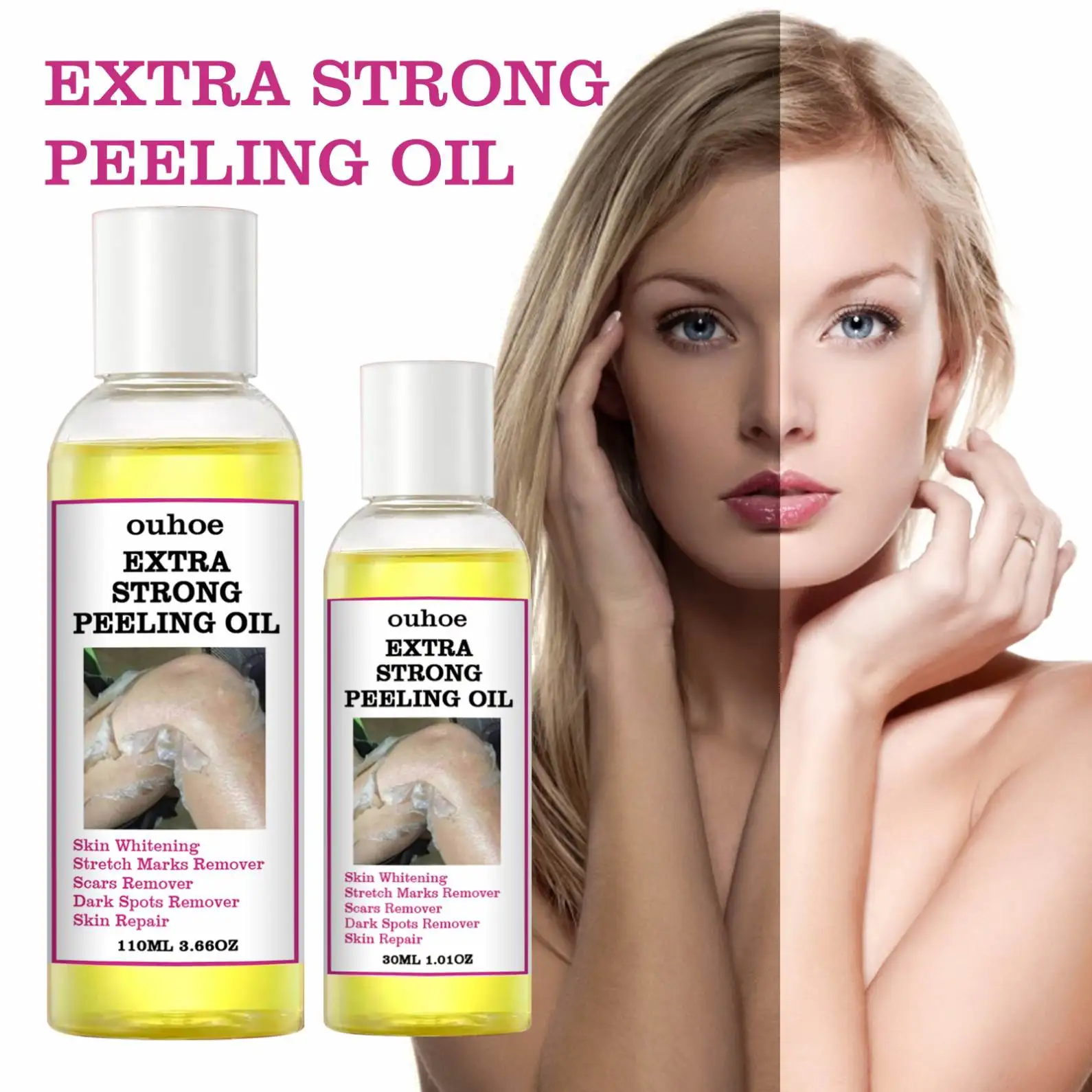 Private label Extra Strength Yellow Peeling Oil Elbows Knees Hands Melanin Bleaching Dark Skin Knuckle Whitening Removal Oil