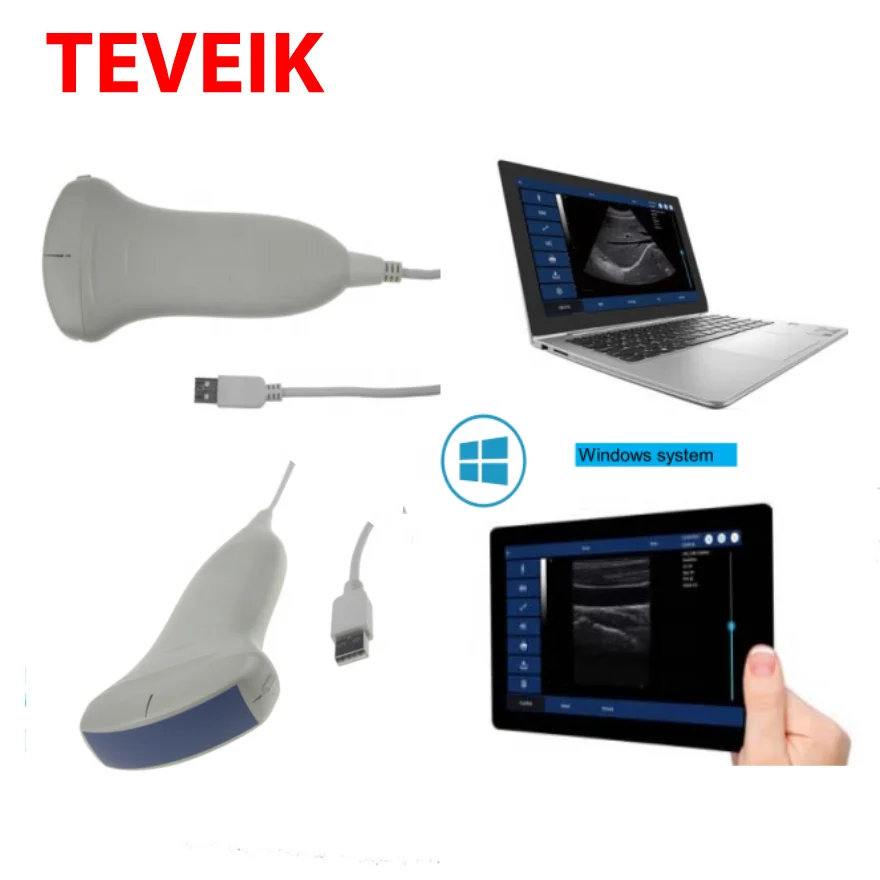 Портативный мини Usb ультразвуковой зонд doppler/usb ультразвуковой сканер