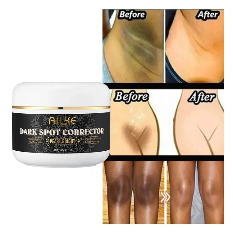 Private Label AILKE Apha Arbutin 4% Pearl Bright 7 Days Dark Spot Corrector Face Stronger Skin Whitening Cream