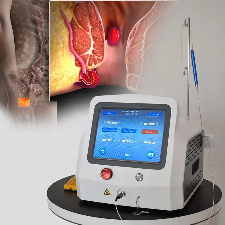 2024 hot selling new laser hemorrhoids surgical diode laser 980nm1470nm gastroenterology colorectal surgery  clinic use device