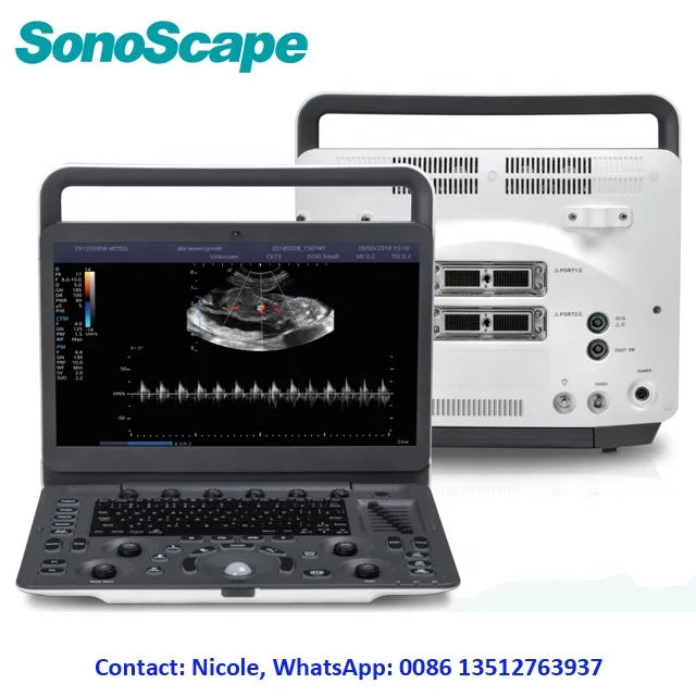 Ветеринарный ультразвуковой допплер Sonoscape E2V