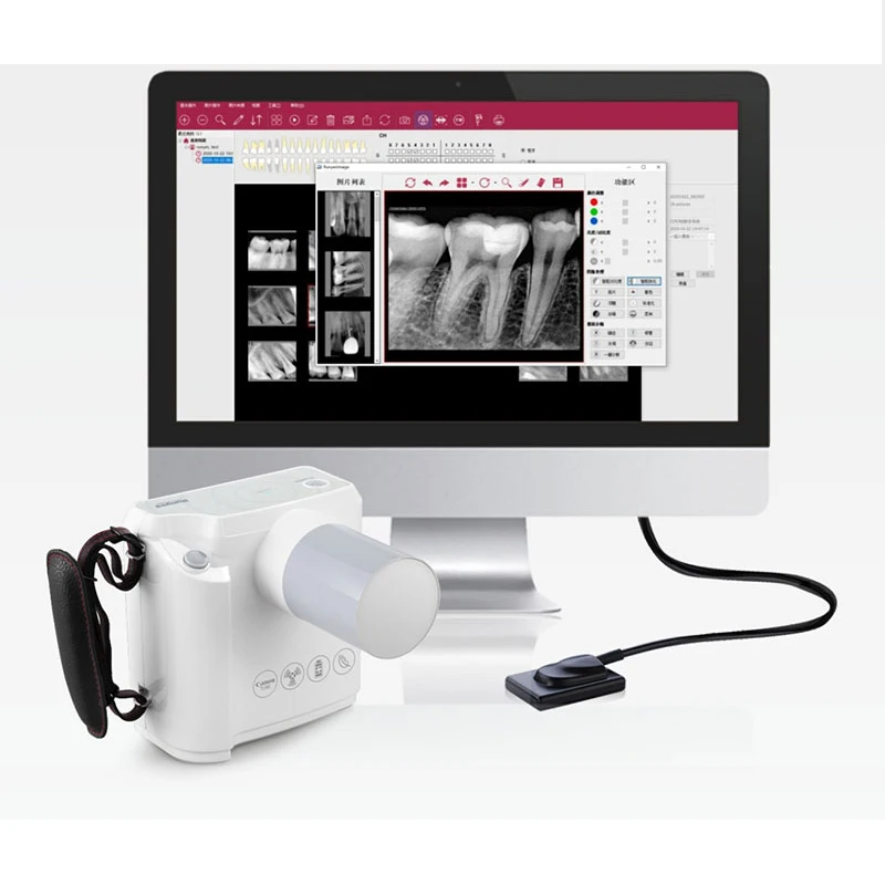 Portable RVG Sensor Dental Xray portable dental xray portable xray machine dental x-ray