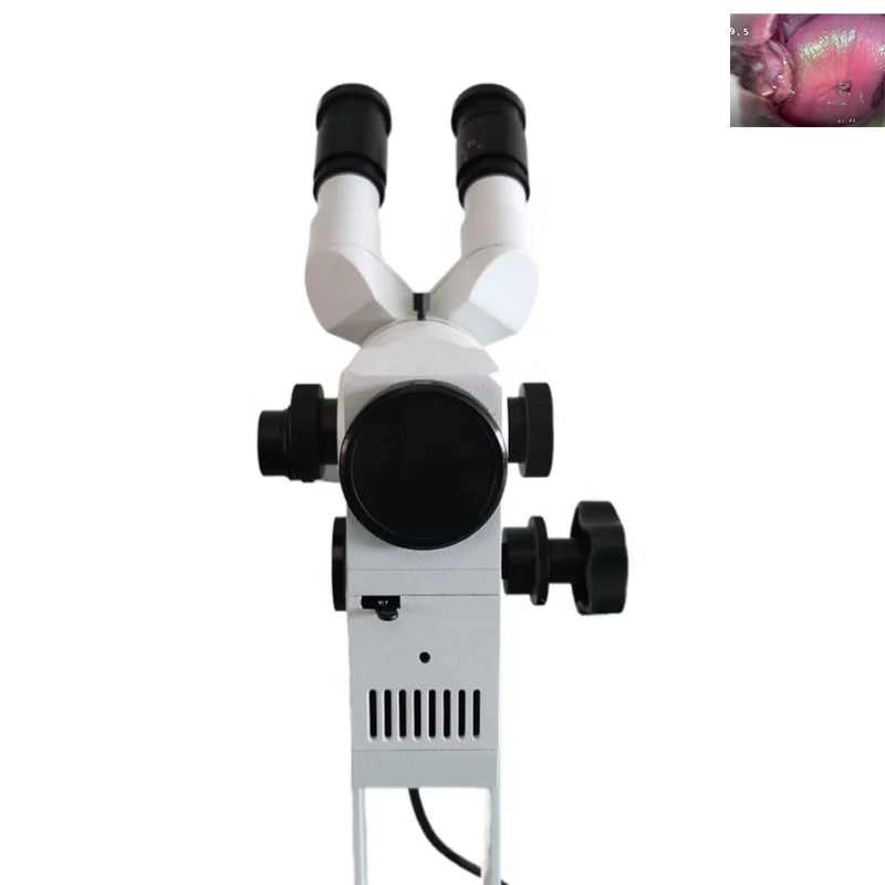 Hot sale Cold Light Camera Binocular Optical Colposcope Gynecological Vaginal Examination Microscope for Gynecologists
